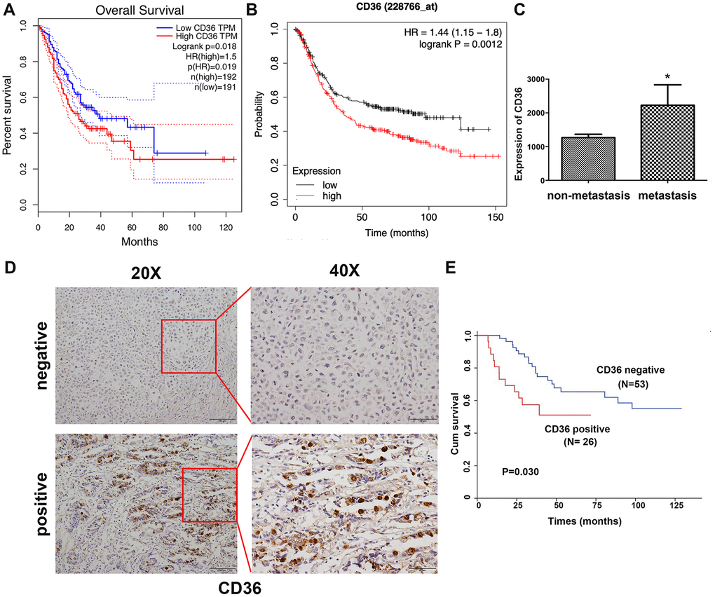 Increased CD36 expression is associated with poor clinicopathological features and clinical outcomes in GC patients. (A) Kaplan-Meier analysis of OS based on CD36 expression in GC patients in TCGA database. (B) Kaplan-Meier analysis of OS based on CD36 expression in GC patients in the GEO database. (C) Analysis of CD36 expression in non-metastatic and metastatic GC samples in TCGA database. *p D) Representative images of CD36 IHC in GC specimens. Top: negative CD36 expression; bottom: positive CD36 expression; left: IHC images, 200×; right: IHC images, 400×. (E) Association between CD36 expression and overall survival in 79 GC patients (p = 0.030).