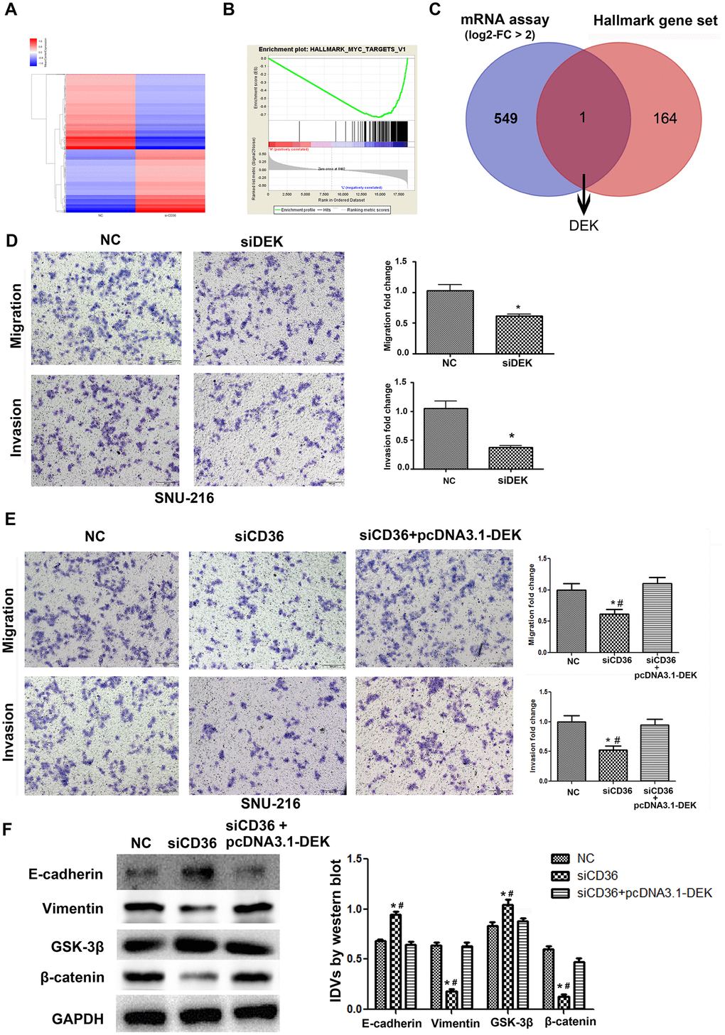 CD36 positively regulates DEK to promote migration and invasion in GC cells. (A) Heatmap of log2-fold gene expression changes in SNU-216 cells transfected with NC/siCD36. (B) Enrichment of genes within the Myc-targets-V1 pathway in the CD36-down-regulated Hallmark gene set. (C) Venn diagram of candidate genes downstream of CD36 obtained from combined mRNA array and MSigDB Hallmark-GSEA analyses. (D) Results of Transwell migration and invasion assays conducted on SNU-216 cells transfected with NC/siDEK. (E) Results of Transwell migration and invasion assays carried out in SNU-216 cells transfected with NC/siCD36/siCD36 + pcDNA3.1-DEK. (F) Western blot analysis of EMT and GSK-3β/β-catenin signaling markers in SNU-216 cells transfected with NC/siCD36/siCD36 + pcDNA3.1-DEK. Data are presented as the mean ± SD. For D-F, *p p 