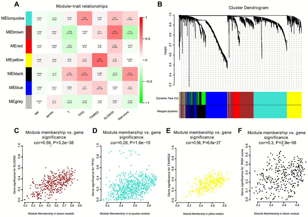 Correlation heat map among various phenotype and co-expression modules. (A) The correlation heat map. (B) The hierarchical clustering tree was showed, where each leaf on the tree represents a gene, and each branch represents a co-expression module. (C) SLC6A20 co-expression module factors were shown. The horizontal axis is module membership; the vertical axis is gene significance. (D) TPX2 co-expression module factors. The horizontal axis is module membership; the vertical axis is gene significance. (E) TXNRD2 co-expression module factors were shown. The horizontal axis is module membership; the vertical axis is gene significance. (F) Risk score correlation module. The horizontal axis is module membership; the vertical axis is gene significance.