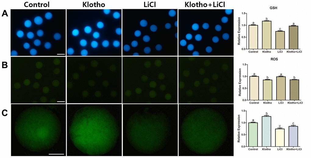 (A) GSH and (B) ROS staining performed in mature oocytes. X100 Magnification. (C) ATP content assay of mature porcine oocytes from different experimental groups. X400 Magnifications. Bars with letters indicate significant differences (P 