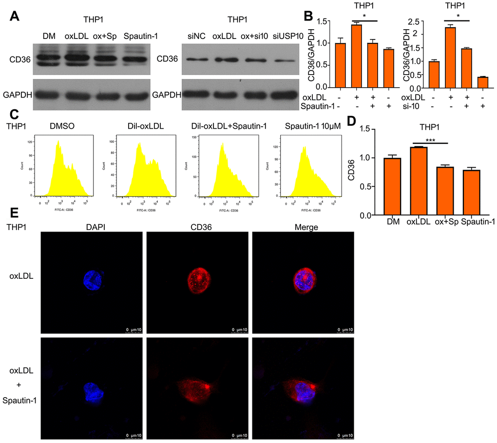 OxLDL-induced the upregulation of CD36 is reduced by USP10 inhibition. (A) Cells were treated with Spautin-1/USP10 siRNA, oxLDL or the combination of the two treatments. Protein was harvested for western blot assay to test CD36 expression. (B) The band of CD36 was counted. (C, D) The treated cells posted with Spautin-1 were stained FITC-CD36 antibody followed by flow cytometry. (E) THP1 cell was incubated with CD36 antibody and DAPI for cell nucleus. *pversus each vehicle control.