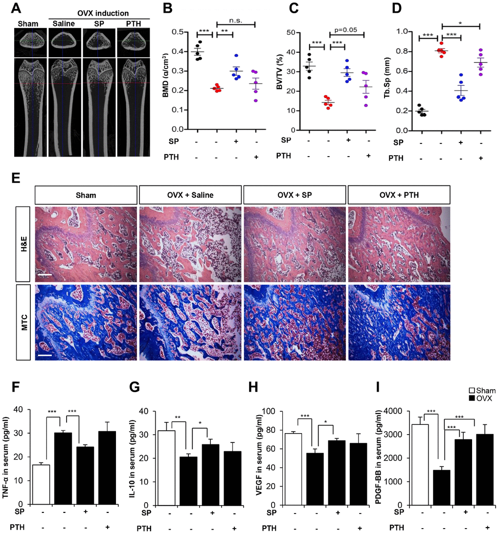 The efficacy of SP is superior to PTH therapy. (A) Representative femoral μCT images from each group. (B–D) Quantitative analyses of the trabecular bone fraction of femur from rats. (E) H&E and Masson’s Trichrome staining of distal femoral metaphysis regions. Scale bar: 100 μm. (F–I) The concentration of TNF-α, IL-10, VEGF and PDGF-BB in serum were analyzed by ELISA. BMD: bone mineral density. BV: trabecular bone volume. TV: tissue volume. Tb.Sp: trabecular bone spacing. p values of less than 0.05 were considered statistically significant (* p 