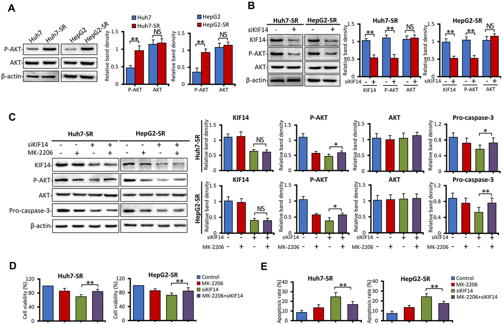 KIF14 silencing reverses acquired resistance to sorafenib by downregulating p-AKT. (A) The protein expression profiles of sorafenib-resistant Huh7-SR and HepG2-SR cells and the corresponding parent cells were detected by western blotting. Representative protein bands are shown. The density of each band was normalized to that of β-actin. (B) Huh7-SR and HepG2-SR cells were transfected with control or siKIF14 for 48 h. The protein expression profiles were detected by western blotting. The density of each band was normalized to that of β-actin. (C–E) Huh7-SR and HepG2-SR cells were pretreated with 0 or 10 μM MK-2206 for 24 h, transfected with control or siKIF14, and incubated in a medium containing MK-2206 for another 24 h. Subsequently, the cells were harvested for analysis. The protein expression profiles were detected by western blotting. The density of each band was normalized to that of β-actin (C). The cell viability (%) of treated cells was compared with that of the corresponding untreated cells (D). The percentages of apoptotic cells (%) were measured by flow cytometry (E). Data represent three independent experiments. NS, not significant. “*” Indicates P