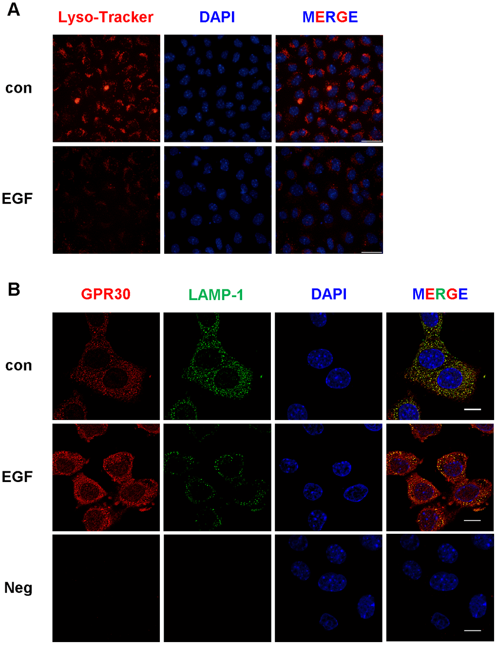 The activity and quantity of lysosomes were both downregulated by EGF treatment in FGCs. Lysosomal activity was detected by Lyso-Tracker red, bar=50 μm (A). The quantity of lysosomes was evaluated by immunostaining (B), GPR30 antibody (red), LAMP1 antibody (green), and DAPI (blue), shown in this panel, bar=10 μm. “Neg” indicates negative control (secondary antibodies only). Three independent replicates were performed for each experiment.