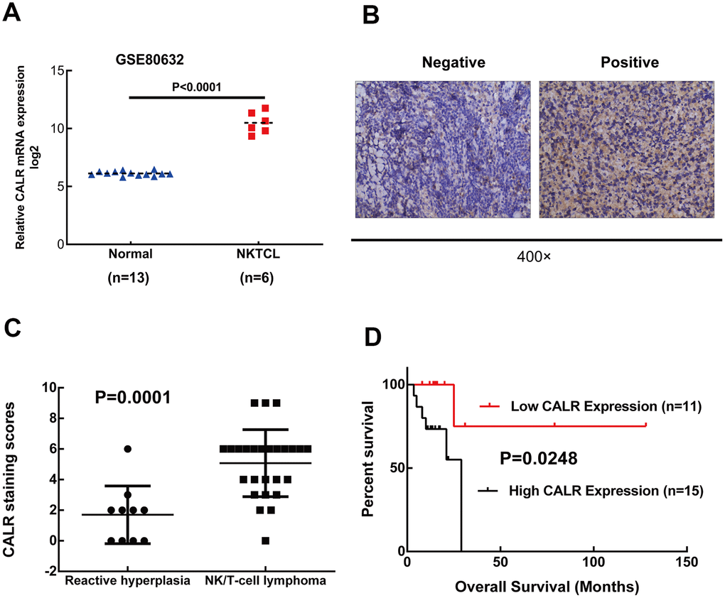 High CALR expression correlates with shorter overall survival in patients with NKTCL. (A) CALR mRNA expression is upregulated in the NKTCL specimens compared to normal control tissues based on the GSE80632 dataset analysis (P U test). Note: The error bars represent standard error. (B) Representative images (400X magnification) show positive and negative immunohistochemical staining of CALR in the 26 NKTCL patient tissues and 10 reactive lymphoid hyperplasia patient tissues (controls). (C) Quantitative analysis based on immunohistochemical staining shows CALR protein levels in the 26 NKTCL and 10 reactive lymphoid hyperplasia patient samples. (D) Kaplan-Meier survival curve analysis shows the overall survival of NKTCL patients with high and low CALR expression. As shown, high CALR expression correlates with shorter overall survival in NKTCL patients.