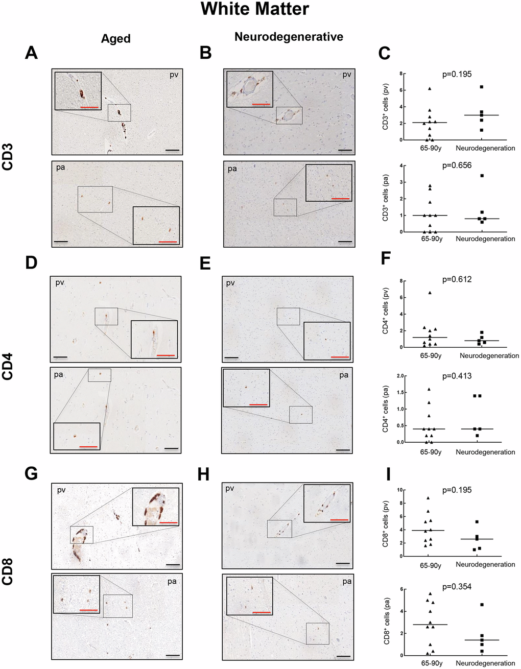 Comparison of CD3+, CD4+ and CD8+ cells with pathological aging in white matter. Representative images and quantification of CD3 (A–C), CD4 (D–F) and CD8 (G–I) expression in aged individuals and patients with neurodegenerative disease. Data are presented as number of positive cells per mm2 with median bar. Red scale bar: 50 μm; black scale bar: 100 μm. White matter (WM), perivascular region (pv), brain parenchyma (pa).