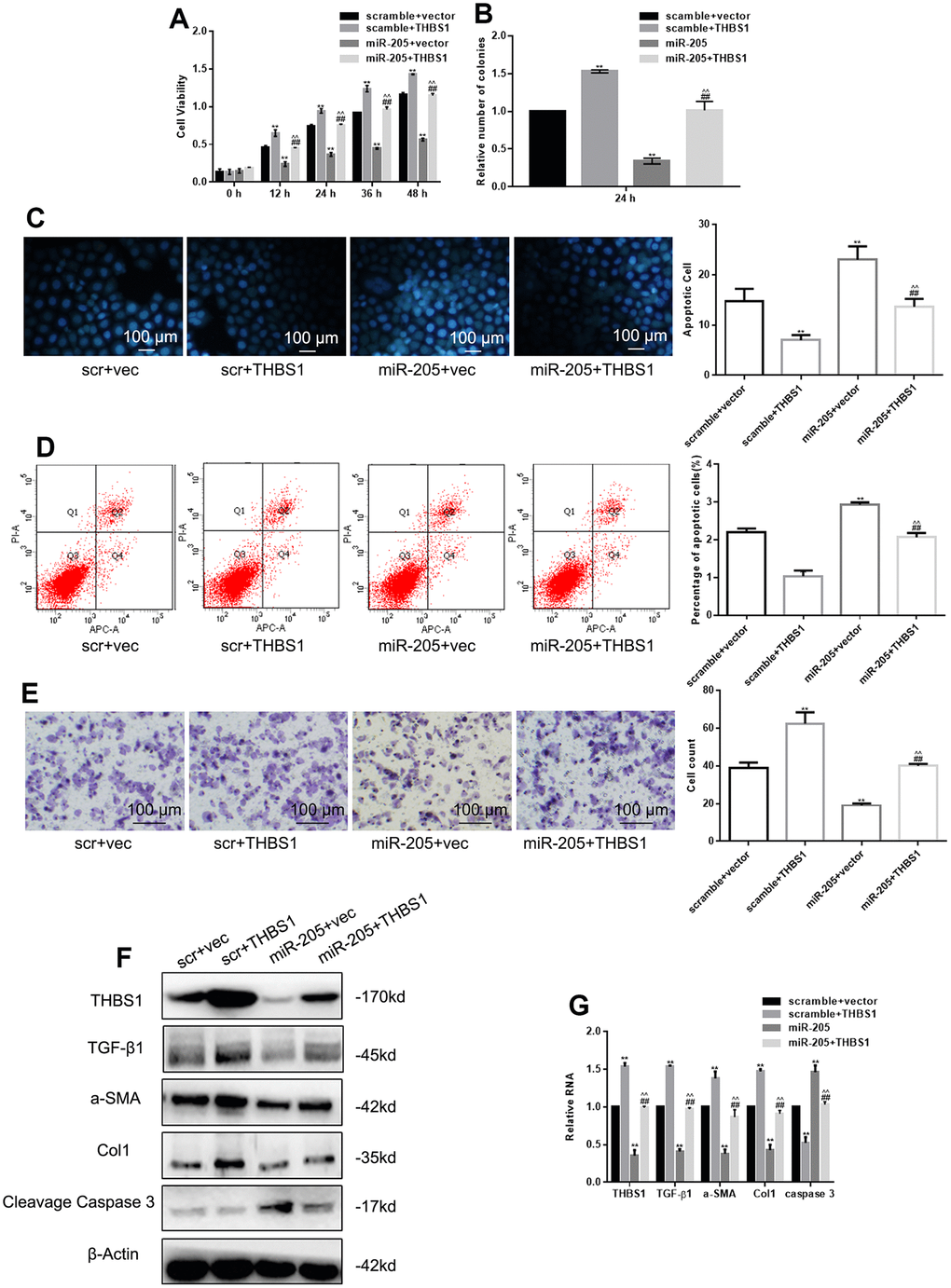 miR-205 restored the effect of THBS1 overexpression on cells. (A, B) The viability of the indicated cells was detected by MTT assay and colony formation assay. **P C, D) The apoptosis of the indicated cells was detected by Hoechst 33258 and Annexin V-PI assay. **P E) The indicated cell migration was measured by Transwell assay. **P F, G) Expression of the indicated genes was measured by Western blot and real-time PCR, respectively. The cells were transfected with scramble plus vector, scramble plus THBS1, miR-205 plus vector, and miR-205 plus THBS1. Results show the mean ± SD of three independent experiments.