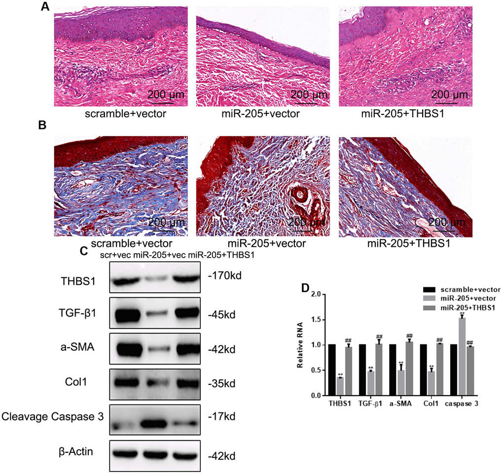 miR-205 arrests hypertrophic scars in hypertrophic scar mice models. (A) The representative images of the HE examination of hypertrophic scars are shown. (B) The representative images of the Masson assay examination of hypertrophic scars are shown. (C, D) THBS1, TGF-β1, α-SMA, Col1, and Cleavage Caspase 3 expression was accessed by Western blot and real-time PCR, **P vs. control. ##P 