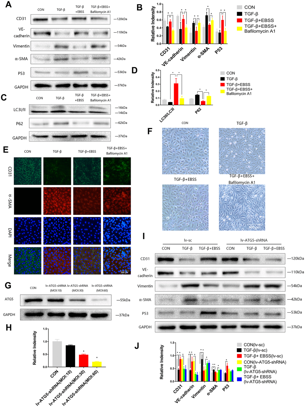 Autophagy modulated MEndT. (A–D) Cells were subjected to TGF-β (20 ng/ml) for 24 h and then treated with EBSS for 4 h, with pretreatment with bafilomycin A1 for 2 h or not. CD31, VE-cadherin, Vimentin, α-SMA, LC3-II/LC3-I, p62 and p53 levels were analyzed by immunoblot. (E) MEndT was assessed by representative images (Scale bars= 500 μm) of immunofluorescence after staining of CD31 and α-SMA. (F) Representative microphotographs (Scale bars= 500 μm) of HUVEC morphological changes. (G, H) Cells were infected with GFP-labeled lv-ATG5 for 24 h, and infection was assessed by the expression of ATG5. (I, J) Cells were treated with TGF-β and EBSS as described above. CD31, VE-cadherin, Vimentin, α-SMA and p53 levels were analyzed by immunoblot. Bar graphs represent data from three independent experiments, and data represent the means±SEM. Unpaired T test (*P