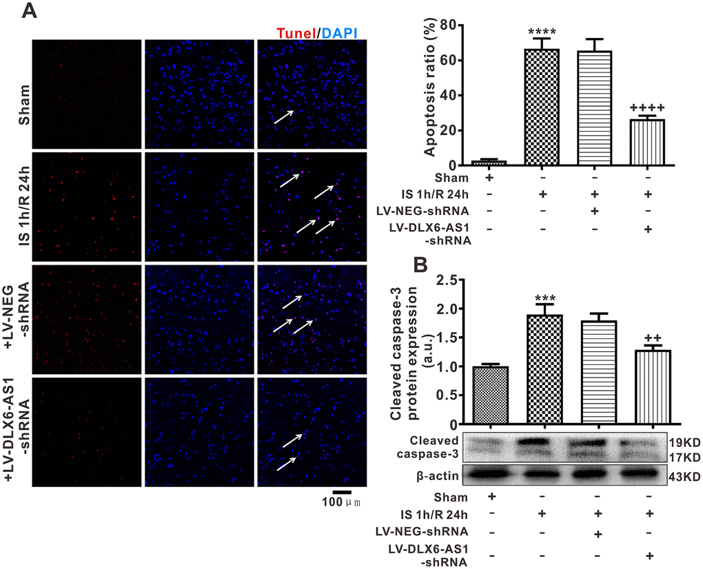 DLX6-AS1 silencing inhibited neuronal apoptosis induced by brain ischemia/reperfusion. (A) Representative images and statistics of TUNEL staining of brain sections for assaying neuronal apoptosis. (B) Cleaved caspase-3 protein expression, measured by western blotting. Data are given as the mean ± SEM (n = 6 in each group). ***P ++P +++P 