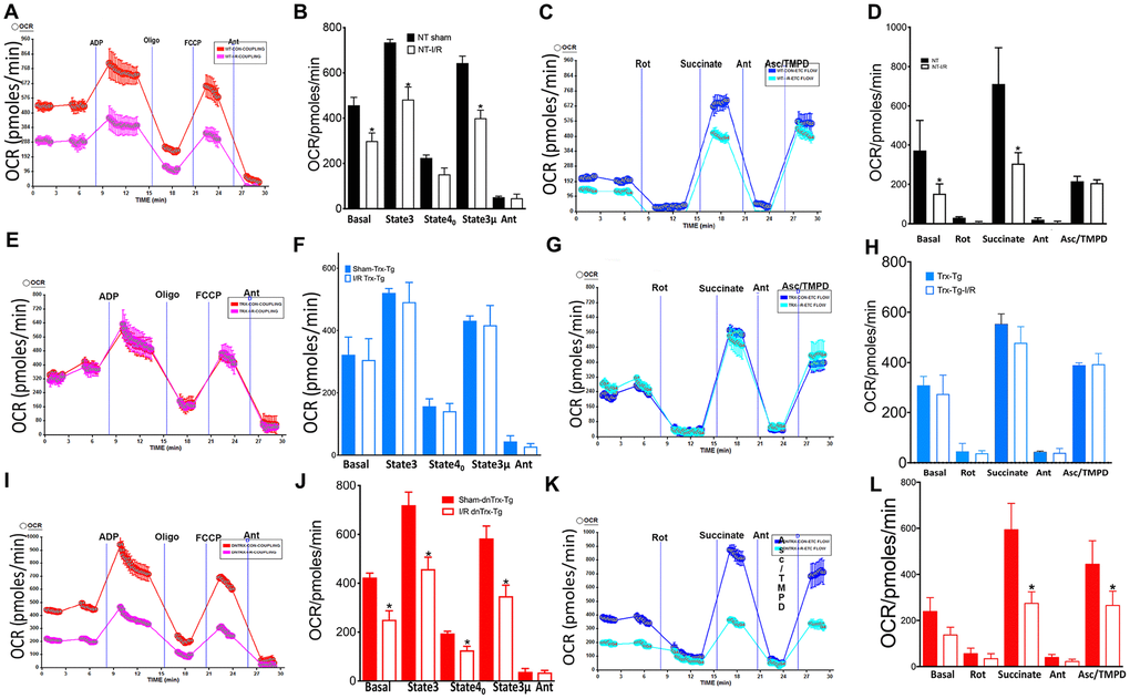 Trx protects against I/R-induced mitochondrial dysfunction. Effect of I/R on coupling and electron flow in mitochondria isolated from mice heart: Mitochondria were isolated from AAR region of sham or I/R subjected NT, Trx-Tg and dnTrx-Tg mice hearts as described in Materials and methods. (A) representative figure of XF24 coupling assay of sham or I/R mice mitochondria from (A) NT; (E) Trx-Tg; (I) dn-Trx-Tg mice, and OCR response to ADP, oligomycin, FCCP and antimycin A using point-to-point measurements. Graph of basal (state 2), state 3, and state 40 respirations in sham and I/R mice heart mitochondria from (B) NT; (F) Trx-Tg; (J) dn-TrxTg. A representative OCR measurement figure of mitochondria from (C) NT; (G) Trx-Tg; (K) dn-TrxTg mice with pyruvate and malate as substrates, and the effect of rotenone, succinate, antimycin A and Asc/TMPD. Sham and I/R mouse mitochondria from (D) NT; (H) Trx-Tg; (L) dn-TrxTg mice with basal, rotenone, succinate, antimycin A and Asc/TMPD mediated OCR (sham = 3, I/R n = 3). Statistical significance was determined with one-way ANOVA followed by Tukey’s post-hoc multiple comparisons test. *P