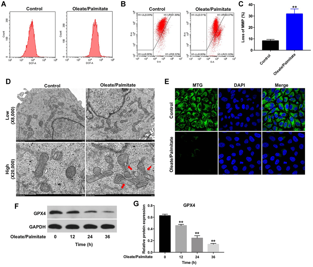 Oleate/palmitate induces ROS generation and decreases MMP in HepG2 cells. HepG2 cells were incubated with oleate/palmitate (2:1 molar ratio) for 24 h. (A) ROS generation was detected as DCF fluorescence using flow cytometry. (B, C) JC-1 staining was used to detect mitochondrial membrane depolarization. (D) Changes in mitochondrial morphology were observed in HepG2 cells using TEM. The mitochondria from oleate/palmitate-treated HepG2 cells were swollen and cristae appeared disrupted (red arrows). Magnification: 20,000x. (E) Mitochondrial distribution in HepG2 cells detected with MTG staining. The green color represents mitochondria staining. (F) HepG2 cells were incubated with oleate/palmitate (2:1 molar ratio) for 0, 12, 24 and 36 h. Levels of GPX4 expression in HepG2 cells were detected with western blotting. GAPDH was used as an internal control. (G) Relative expression of GPX4 in HepG2 cells was quantified by normalization to β-actin. **P