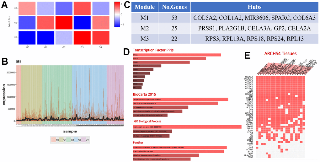 The molecular mechanism by which KRT6A regulates TAMs. (A) CEMiTool was used to find gene modules affecting TAMs through KRT6A by dividing TCGA PAAD mRNA-seq data into five groups by the level of KRT6A expression: Grade 0 (G0), Grade 1 (G1), Grade 2 (G2), Grade 3 (G3), and Grade 4 (G4), 6A expression where G0 expressed the lowest amounts of KRT6A (average RPKM = 0) and G4 expressed the highest amounts of KRT6A (average RPKM = 193.24). (B) Expression of a gene module (Module 1) in each PDAC patient. (C) Major genes and the number of genes in each module. (D) Transcription factor PPI network and pathway enrichment of genes in Module 1. (E) Cell type enrichment of genes in Module 1.