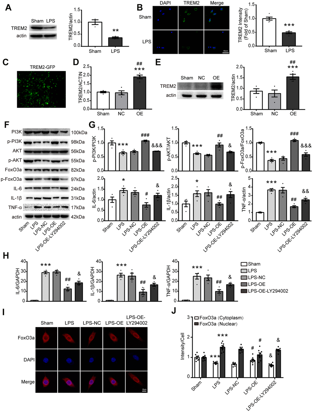 TREM2 overexpression activates the PI3K/AKT/FoxO3a pathway and inhibits the inflammatory response in BV2 cells. (A) Meaningful western blot bands and gray analysis of TREM2 (n=3), **PB) Confocal images and quantification analysis of fluorescence intensity of TREM2 (n=5). Scale bar, 50 μm. ***PC) A image of the overexpression of TREM2 plasmid after cell transfection. (D, E) TRME2 mRNA and protein were detected by qPCR and Western blot, respectively, in whole-cell lysates (n=4). ***PF, G) Representative western blot bands (F) and its quantification (G) of p-PI3K, p-AKT, p-FoxO3, IL-6, IL-1β and TNF-α (n=4). (H) mRNA levels of proinflammatory cytokines (IL-1β, IL-6, TNF-α) were examined by qPCR (n=4). (I) The FoxO3a (red) were stained in the cells and observed by confocal microscope. (J) The quantification of FoxO3a in both nucleus and cytoplasm in each group (n=8); Magnification= 40x. Scale bar=10μm. * P