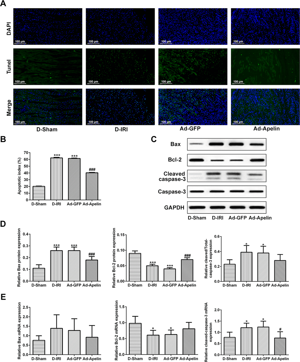 Observation for the apoptosis reduced by the injection of recombined lentiviral vector expressing Apelin. (A, B) Apoptosis in myocardium was determined by TUNEL analysis. Scale bar=50 μm. (C, D) Protein levels and analysis of Bcl-2, Bax, and cleaved caspase-3 detecting by western blot assay. (E) mRNA levels of Bcl-2, Bax, and cleaved caspase-3 detecting by RT-qPCR. * P*** P###P