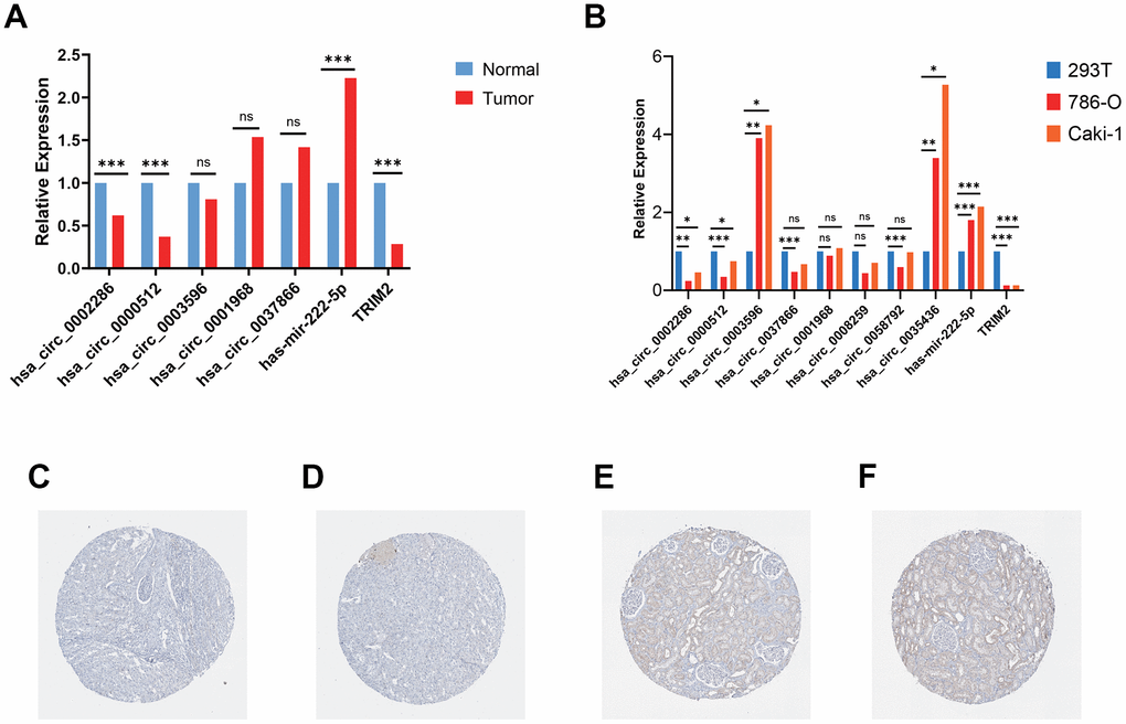 Validation of circRNAs and TRIM2 in ccRCC tissues and cell lines. (A) Bar plot for the relative expression of five hub circ