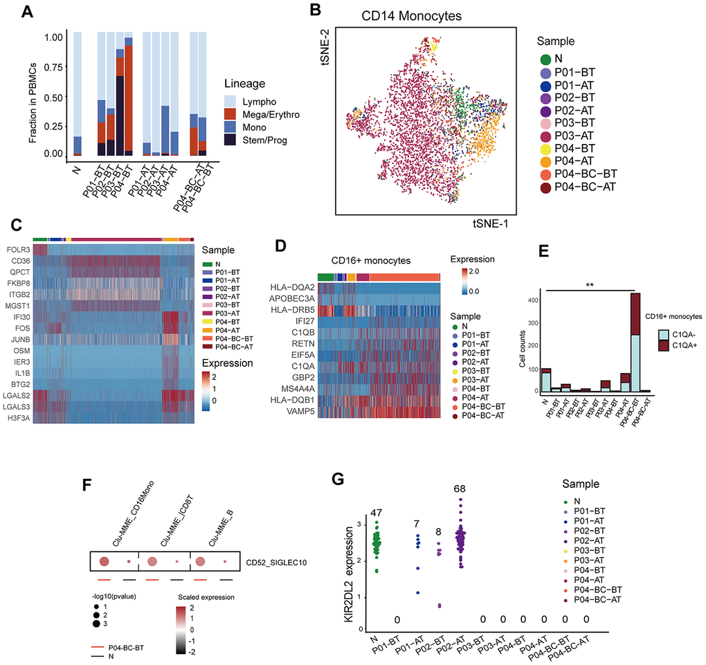 Modulation of the immune structure in response to imatinib treatment (A) Bar plots showing the fraction of different cell lineages in each sample. (B) TSNE plot of the re-clustering result of CD14+ monocytes. Cells are highlighted in colors indicating sample of origin. The number of cells in each cluster is listed in Supplementary Table 2. (C) Heatmap displaying the expression profiles of CD14+ monocytes across different samples. Top differentially expressed genes in each sample are indicated. (D) Heatmap comparing the expression profiles of CD16+ monocytes across different samples. The selected marker genes are indicated. (E) Bar plots comparing the detected C1QA-expressing monocytes across different samples. P value was calculated using a Fisher’s exact test. (F) Dot plots comparing the CD52-SIGLECT10 ligand-receptor interactions between P04-BC-BT and N. The p value was calculated using a permutation test. (G) Beeswarm plots showing the expression of KIR2DL2 among all cells across samples. The number of cells expressing KIR2DL2 in each sample is indicated.