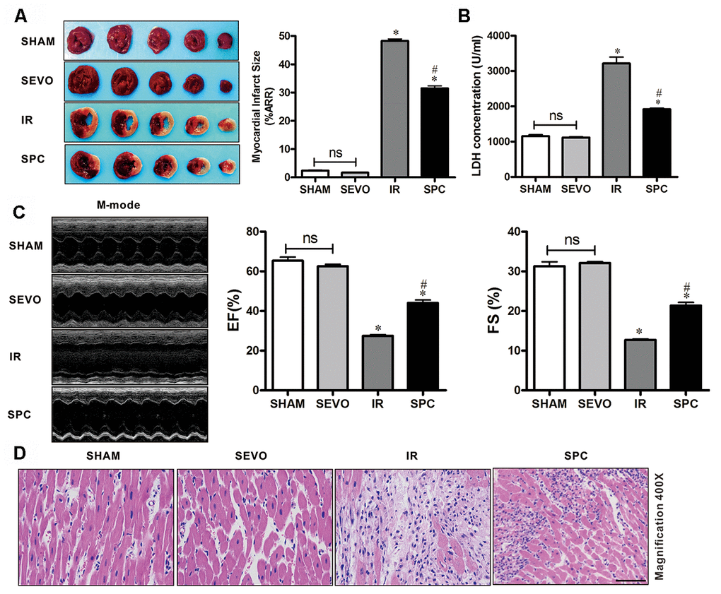 SPC reduced myocardial infarction size, recovered cardiac function, decreased LDH level and attenuated histopathological changes. (A) Myocardial infarct size was measured by 1% TTC and expressed as a percentage of area at risk. n=6/group. (B) Myocardial necroptosis marker enzyme LDH was determined by commercially available LDH kits. n=6/group. (C) Representative M-mode images of echocardiography and EF%, FS% were recorded in all groups. n=8/group. (D) Representative H&E staining images are shown (magnification, 400×). Scale bar, 50μm. n = 3/group. The columns and errors bars represent means ± SD. * P 