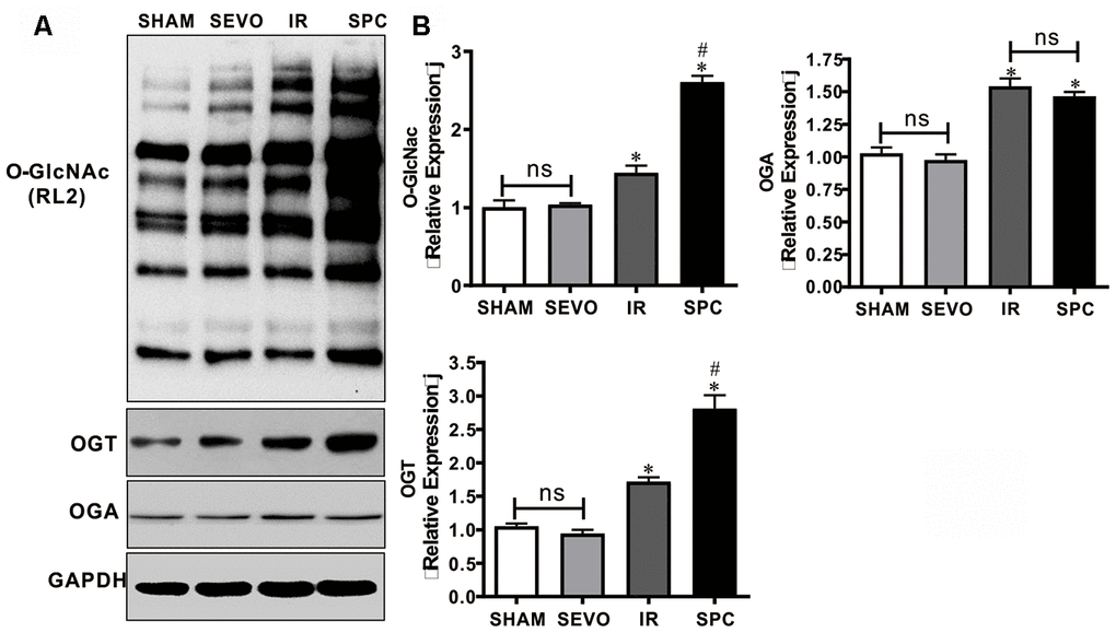 SPC up-regulated the expression of O-GlcNAc and OGT proteins. (A) Representative protein images of O-GlcNAc, OGT and OGA from all groups were shown. (B) Quantitative analysis of O-GlcNAc, OGT and OGA proteins were performed. n = 3 /group. The columns and errors bars represent means ± SD. * P 