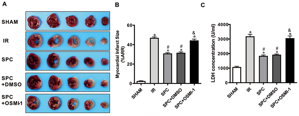 OSMI-1 eliminated SPC-mediated decreases in cardiac infarction and the LDH level. (A) Infarct size was determined by using 1%TTC staining. Represetnative images were shown. (B) Infarct size was expressed as a percentage of area at risk. n=6/group. (C) Myocardial necroptosis marker enzyme LDH level in all groups. OSMI-1, the OGT inhibitor; DMSO, the OSMI-1 solvent. n=6/group. The columns and errors bars represent means ± SD. * P 