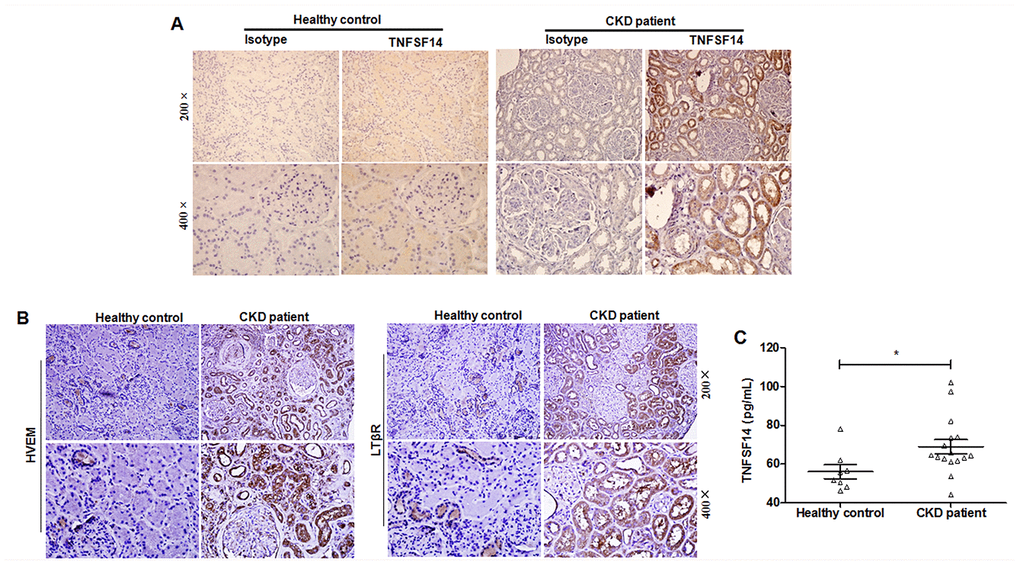 Increased TNFSF14 expression in patients with fibrotic nephropathy. (A) The expression of TNFSF14 in human kidney sections from healthy control, CKD patients were detected by immunohistochemistry (upper lane, original magnification×200; lower lane, original magnification×400). (B) The expression of TNFSF14 receptors (HVEM and LTβR) in biopsied human kidney specimens from patients with CKD were detected by immunohistochemistry. (upper lane, original magnification×200; lower lane, original magnification×400). Nontumoral kidney tissue from patients with renal cell carcinoma was used as healthy control. (C) TNFSF14 levels in serum from healthy controls (n = 8) and patients with CKD (n = 16) were measured by ELISA. The data were representative of the results of three independent experiments. Values are represented as mean ± SEM. *P  0.05.