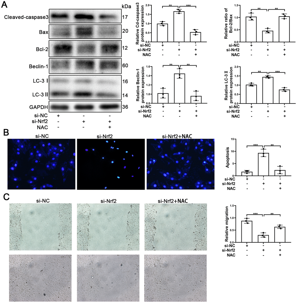 NAC facilitated the survival and migration of EPCs after silencing of Nrf2. EPCs were divided into treatment groups representative of the control, si-Nrf2 and, si-Nrf2 + NAC. (A) The levels of Cleaved-caspase3, Bax, Bcl-2, Beclin-1, LC-3, and GAPDH proteins in EPCs were determined by using Western blotting. (B) We used Hoechst 33258 staining to detect the apoptosis of EPCs. Scale bars = 5 μm. (C) Migration of EPCs was determined by the application of wound healing assays (details given in methods). All experiments were performed in triplicate. Scale bars = 20 μm. *p 