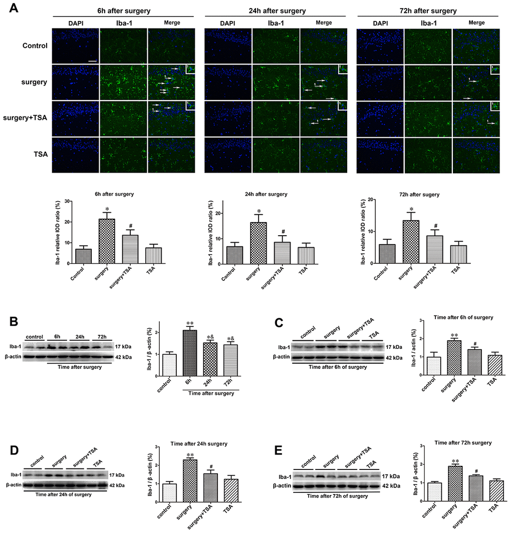 TSA inhibits surgery-induced hippocampal microglia activation in aged rats. (A) Immunofluorescence analysis and semi-quantification of higher expression of Iba-1 protein in the hippocampal CA1 area were observed at postoperative 6 h, 24 h and 72 h, and this staining was significantly inhibited by TSA pretreatment (Iba-1, green; cell nuclei, blue. Magnification 400 ×, Scale bar = 50 μm). Western blot analysis and semi-quantitative data showing protein expression (B–E), indicating that the expression levels of Iba-1, a microglia activation marker, increased significantly at 6 h, 24 h and 72 h after laparotomy, and it peaked at 6 h and decreased within 72 h post-surgery, which was significantly inhibited by TSA pretreatment, with β-actin used as a loading control. Data are given as means {plus minus} SEM, n = 5. *P 