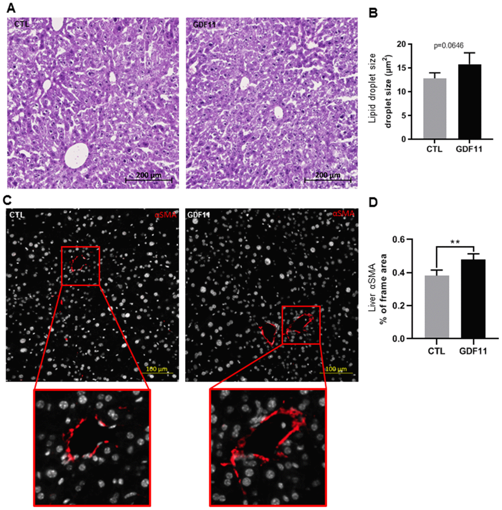 GDF11 induces HSCs activation in mice. 16-18 months old wild type C57/BL6J mice (n=5 mice per group) were injected daily (for nine days) with either GDF11 (1 mg/kg) or saline. (A) Representative images of H&E stained livers (200x magnification) from the livers of CTL and GDF11-treated mice. (B) Quantitative morphometric analysis of total lipid area (%) as in (A). (C) Representative images of αSMA immunostaining (200x magnification) in the livers of CTL and GDF11-treated mice. (D) Quantitative morphometric analysis of αSMA immunostaining (% of total imaged area, n=5 per group, at least fifteen randomly chosen fields per sample were evaluated). Data are represented as the mean ± SD. ** p