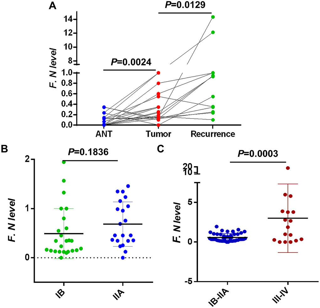 Intratumoral F. nucleatum levels in cervical cancer tissues. (A) F. nucleatum levels in 23 pairs of (Left) adjacent non-tumor tissues (ANT) vs. cervical cancer and (Middle) cervical cancer vs. (Right) recurrent cervical cancer tissues. (B) The relative amount of F. nucleatum in 23 cervical cancer tissues within I/II stage and (C) 20 advanced cancer tissues III/IV. Differences were assessed with a paired two-tailed t-test. F.N, F. nucleatum