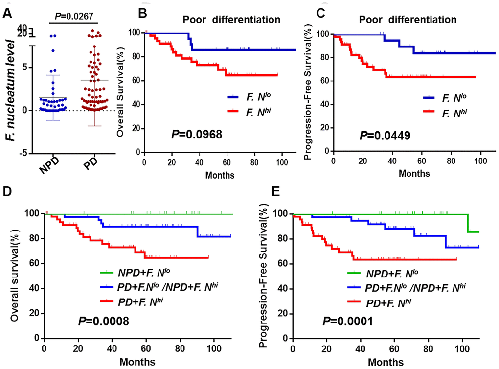 The association between F. nucleatum levels and tumor histological differentiation. (A) F. nucleatum burdens in 112 tumors tissues. The mean amount of F. nucleatum was increased in poor (n = 69) differentiation tumors compared with well (n = 6) or moderate (n = 37) differentiation tumors. Data are expressed as mean±SD (bars); Kaplan-Meier analysis of OS (B) and PFS (C) for patients with high (red, n = 48) or low (blue, n = 21) F. nucleatum levels in poor differentiation (PD) cancer tissues; Kaplan-Meier analysis of OS (D) and PFS (E) for patients with poor differentiation and high F. nucleatum levels (red, n = 47, PD+F. nucleatumhi) vs. poor differentiation and low F. nucleatum levels or non-poor differentiation(NPD, well/moderate differentiation) and high F. nucleatum levels (blue, n = 40, PD+F. lo/NPD+F. hi) vs. NPD and low F. nucleatum levels (green, n = 24, NPD+F. nucleatumlo). Differences were assessed with an unpaired two-tailed t-test. The OS and PFS curves were generated by the Kaplan–Meier method and analyzed using the log-rank test.