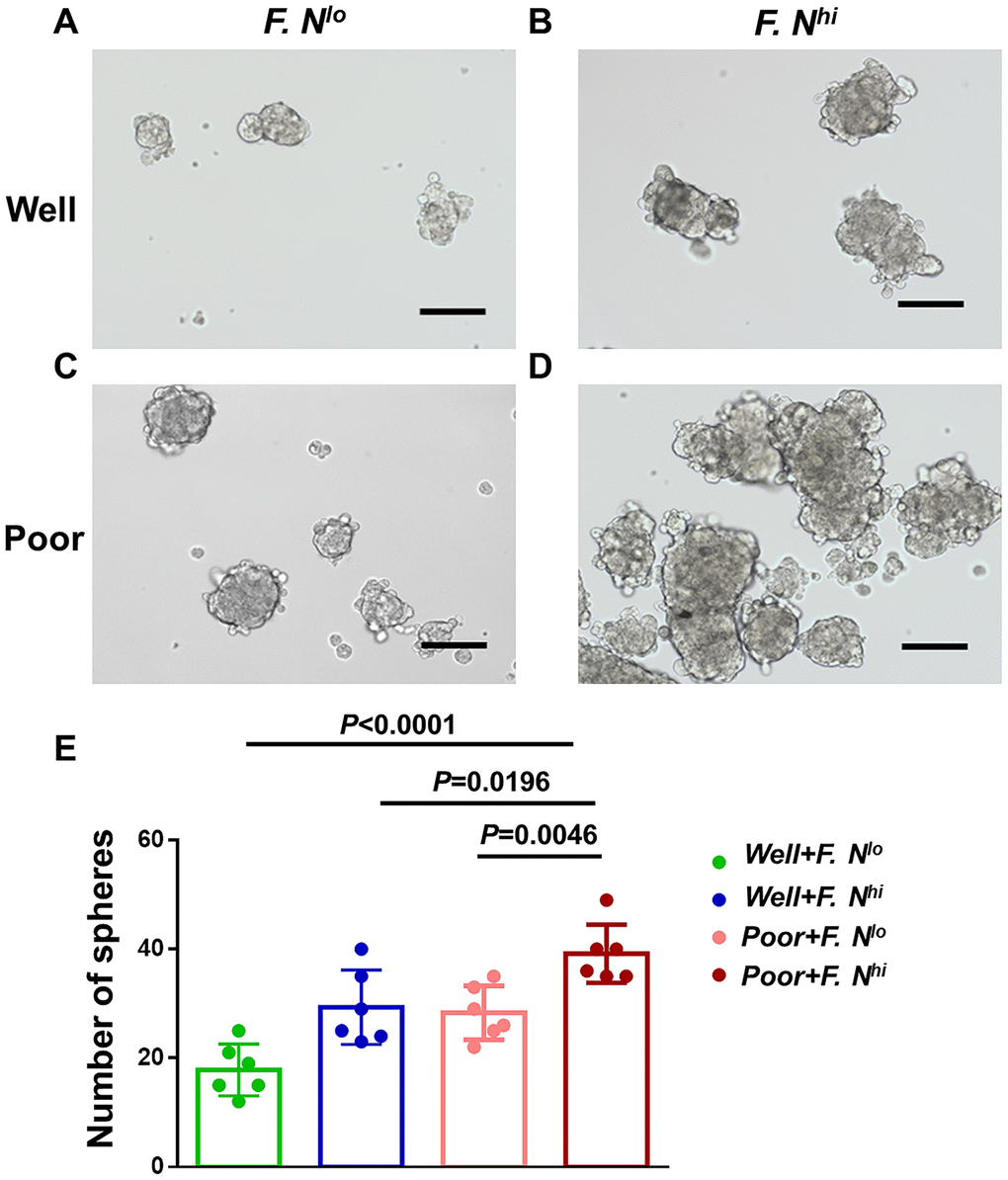 High intratumoral F. nucleatum burden is associated with cervical cancer cells stemness. Spheres in primary cervical cancer cells sorted for differentiation and intratumoral F. nucleatum levels- Representative Sphere formation capability for cells from patients with well differentiation and low (A) or high (B) amounts of F. nucleatum, or patients with poor differentiation and low (C) or high (D) levels of intra-tumor F. nucleatum. (E) Statistical analyses of Spheres for above patients. Scale bar = 200μm. Data are expressed as mean±SD (bars); Primary cells were obtained from cervical cancer patients and spheres were formed by culturing 3*103 cells in 3 wells. The number of spheres (>75μm) was counted respectively. All experiments were performed in triplicate.