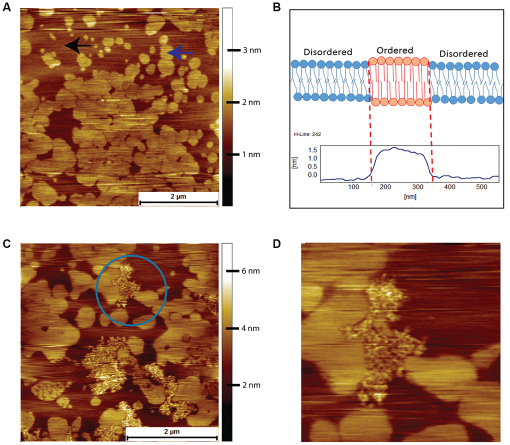 AFM contact mode images in PBS of DOPC/DPPC model supported lipid bilayers and their interactions with human Aβ peptide. (A) Supported bilayer made from DOPC to DPPC in a molar ratio of 3:1. Typical phase separation is observed with the DPPC gel phase islands (example indicated by the blue arrow) surrounded by the liquid disordered DOPC phase (example indicated by the black arrow). (B) Proposed origin of height difference of the gel phase relative to liquid disordered phase. (C) DOPC/DPPC bilayer after exposure for 2 hours to 8 μM of human Aβ. The Aβ has adsorbed exclusively onto the DOPC liquid disordered phase, the DPPC gel phase remaining untouched. (D) A zoom in of the area enclosed in the circle in (C)., the Aβ being seen to avoid the DPPC gel domains, even the small central DPPC gel domain remaining untouched.