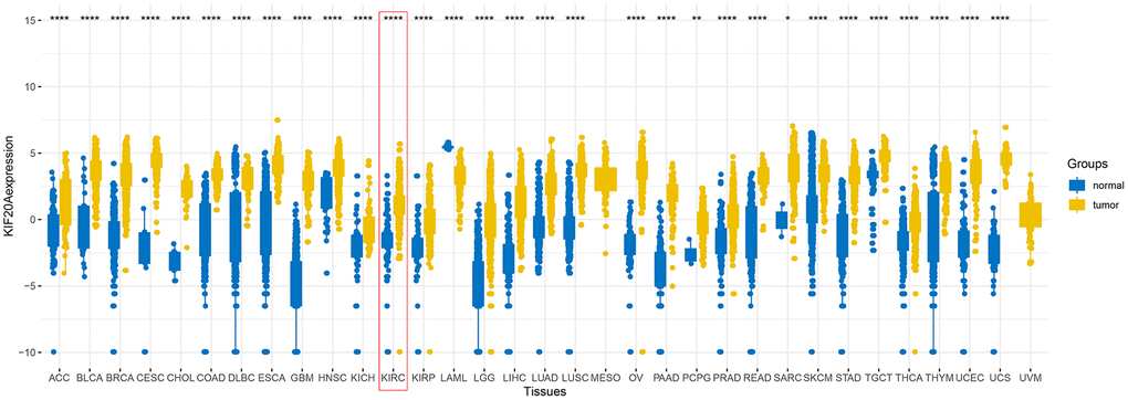 The expression of KIF20A after merging TCGA and GTEx databases.