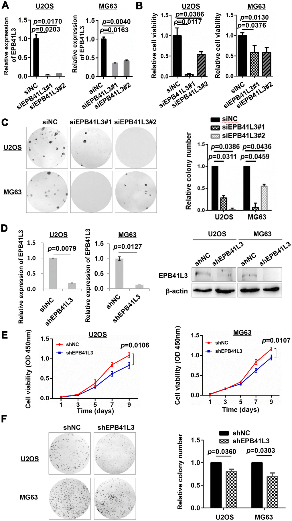 EPB41L3 knockdown decreases osteosarcoma cell viability. (A) Knockdown efficiency of EPB41L3 siRNAs (siEPB41L3#1 and siEPB41L3#2) versus control siRNA (siNC) was examined by qRT-PCR. Data were presented as the mean ± standard error of the mean of two independent experiments. (B) U2OS and MG63 were transfected with siEPB41L3 (siEPB41L3#1 or siEPB41L3#2) or control siRNA (siNC), and the cell viability was determined by CCK-8 assay assessed at 96 h post-transfection. Data were presented as the mean ± SD of three experimental repeats. (C) Colony formation assays for the effects of EPB41L3 silence in U2OS and MG63. Statistical results of colony formation numbers normalized to siNC were presented. (D) The efficiency of knocking down by lentiviral delivery of shRNA (shEPB41L3) was assayed by qRT-PCR (left panel) and western blot (right panel). (E) CCK-8 assays for the effects of stably expressing shNC and shEPB41L3 on the proliferation of U2OS and MG63 cells. (F) Colony formation assays for the effects of stably expressing shNC and shEPB41L3 in U2OS and MG63. Statistical results of colony formation numbers normalized to shNC were presented. NC, negative control; si, small interfering RNA.