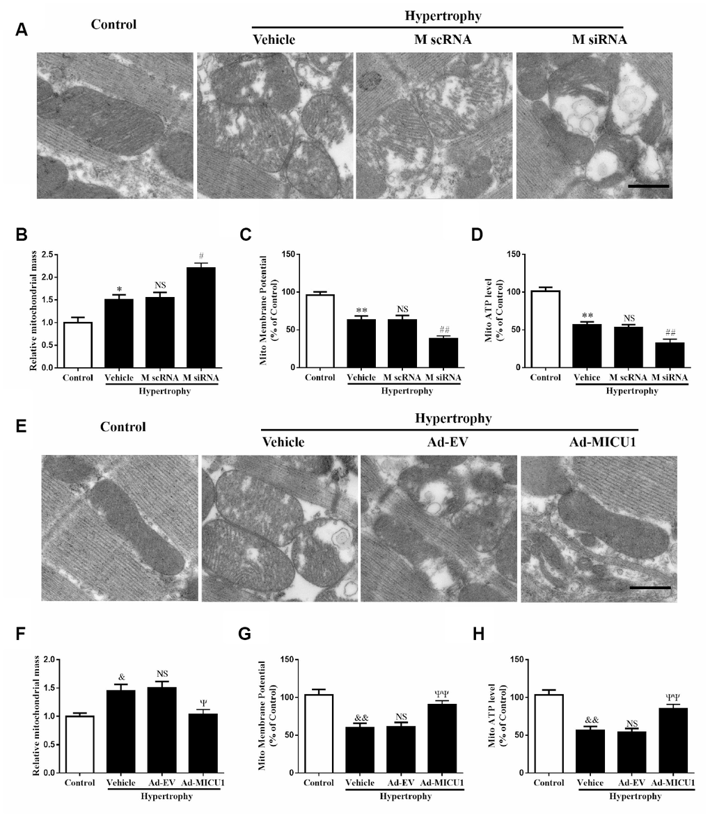 Mitochondrial disorder contributed to cardiac hypertrophy induced by MICU1 deficiency. (A, E) Mitochondrial morphology was observed by transmission electron microscopy in control, MICU1 knockdown (A) and MICU1 overexpression mice (E). Scale bars=500 nm. (B, F) Mitochondrial mass was analyzed by Image J in different mice. (C, G) Mitochondrial membrane potential (ΔΨm) level was measured by JC-1 kits in different mice. (D, H) Mitochondrial ATP content was determined by frefly luciferase-based ATP assay kits. All the data represent the means ± SEM. N=6-8/group. **P##P&&PΨΨP