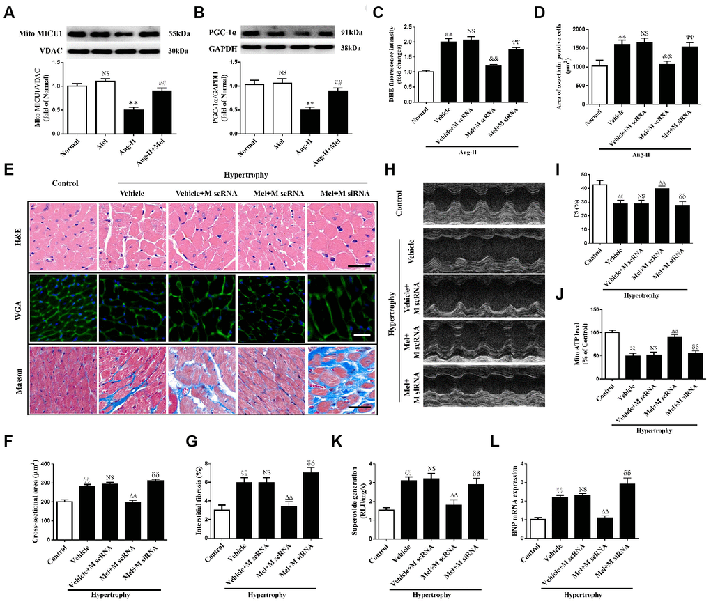 Melatonin ameliorated Ang-II-induced cardiac hypertrophy by increasing MICU1 pathway. (A, B) Western blotting was used to determine expression levels of MICU1 (A) and PGC-1α (B) in NMVMs with the treatment of Ang-II and melatonin. (C) ROS generation in NMVMs was measured by DHE staining. (D) Cell surface areas were measured in neonatal mice ventricular myocytes (NMVMs). (E–G) H&E staining and wheat germ agglutinin (WGA) staining were used to measure the enlargement of cardiomyocytes and Masson staining was used to determine interstitial fibrosis. (H) Representative echocardiographic image of the left ventricle in different mice was represented. (I) FS was used to reflect cardiac function. (J) Mitochondrial ATP content was determined by ATP assay kits. (K) Superoxide content was quantified with lucigenin-enhanced luminescence. (L) The mRNA expression levels of BNP were measured by qRT-PCR. Mel, melatonin. Presented values are means ± SEM. N=6-8/group. **P##P&&PΨΨPξξPΔΔPδδP