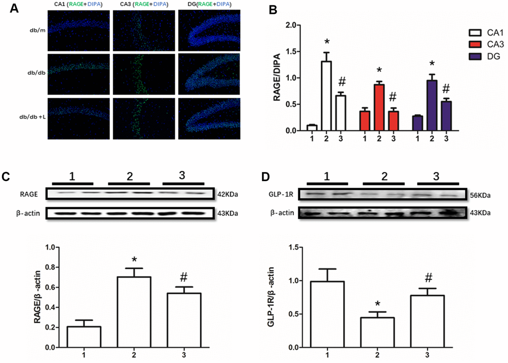 Liraglutide restored RAGE and GLP-1R of db/db mice in hippocampus. "*" significant difference between db/db mice and db/m mice; "#" significant difference between db/db mice with liraglutide and db/db mice without liraglutide; "db/m" of (A) db/m mice without liraglutide; "db/db" of (A) db/db mice without liraglutide; "db/db + L" of (A) db/db mice with liraglutide at a concentration of 240ug/Kg; "1" of (B–D) db/m mice without liraglutide; "2" of (B–D) db/db mice without liraglutide; "3" of (B–D) db/db mice with liraglutide at a concentration of 240ug/Kg.