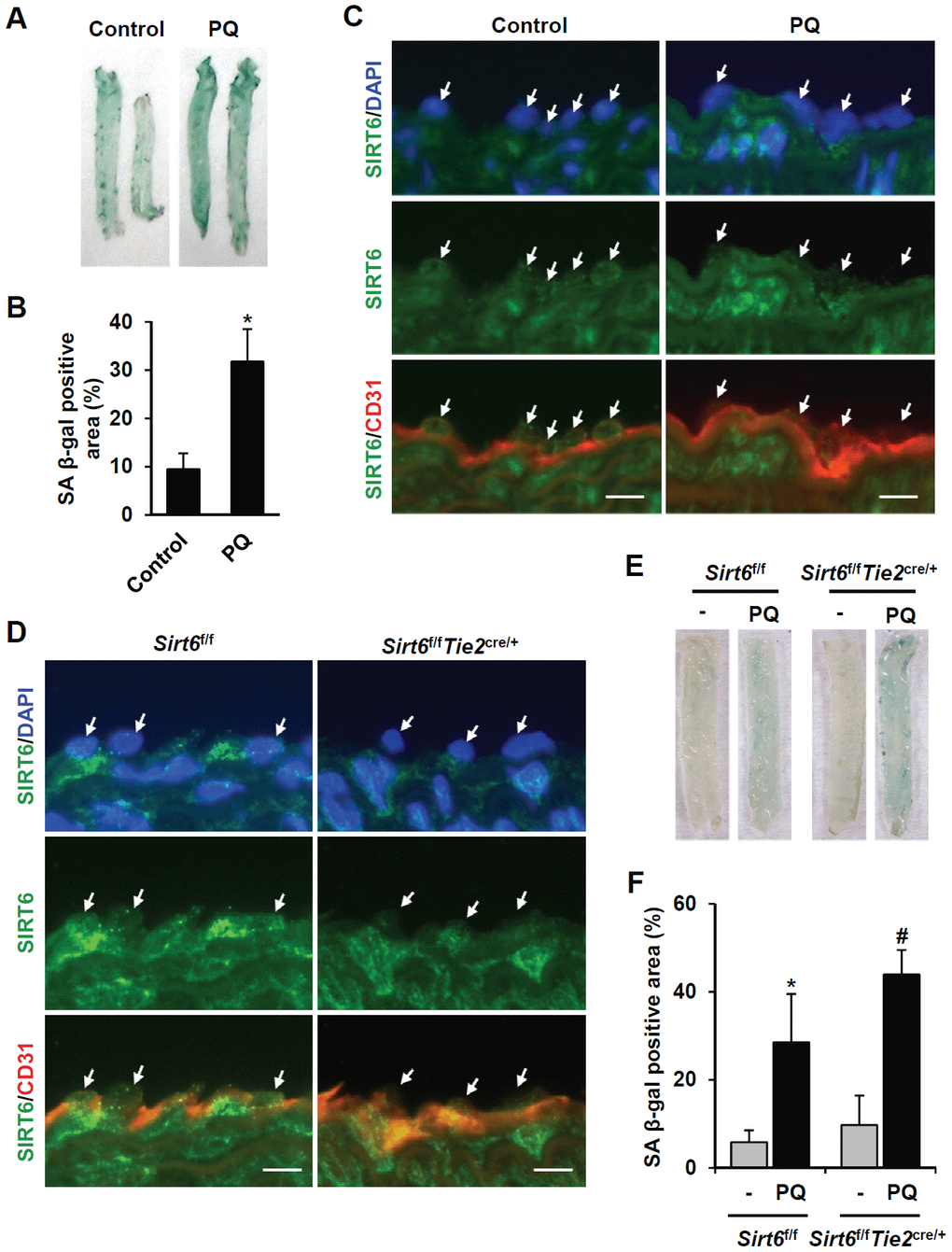 SIRT6 expression is downregulated in mouse senescent aorta, and endothelial-specific Sirt6 knockout in mouse deteriorates oxidative stress-induced senescence in the aorta. (A) Images from SA β-gal staining of thoracic aorta from C57/BL6 mice injected with PBS or PQ. (B) Graph showing the relative SA β-gal-positive areas in PBS- and PQ-treated thoracic aortas. SA β-gal-positive areas were quantified using ImageJ. The experiment was repeated twice. Data represent the mean percentage ± SD (n = 4). *P C) Double immunofluorescence staining showing SIRT6 and CD31 expression in control and PQ-treated thoracic aortas. The sections were co-stained with anti-SIRT6 and anti-CD31 antibodies. DAPI was used to stain nuclei. Arrows indicate nuclei of endothelial cells. Scale bars represent 10 μm. (D) Double immunofluorescence staining confirming Sirt6 knockout in Sirt6f/fTie2cre/+ mouse thoracic aortas. The sections were co-stained with anti-SIRT6 and anti-CD31 antibodies. DAPI was used to stain nuclei. Arrows indicate nuclei of endothelial cells. Scale bars represent 10 μm. (E) Dissecting microscope images of thoracic aortas stained for SA β-gal. The thoracic aortas were obtained from Sirt6f/f and Sirt6f/fTie2cre/+ mice injected with PBS or PQ. (F) Relative SA β-gal-positive areas in the mouse thoracic aortas from Sirt6f/f and Sirt6f/fTie2cre/+ mice injected with PBS or PQ. The percentage of SA β-gal-positive areas was quantified using ImageJ. The experiment was repeated twice. Data are shown as the mean ± SD (n = 4). *P Sirt6f/f. #P Sirt6f/f treated with PQ.