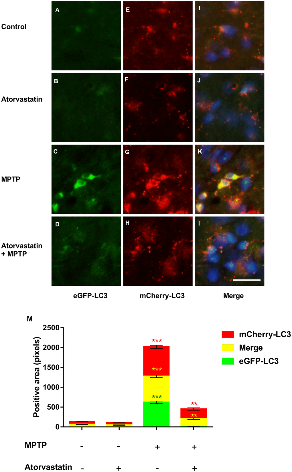 Changes in autophagic flux in MPTP mice. The expression of eGFP-LC3 in substantia nigra neurons of autophagic flux marker mouse models(A–D). The expression of mCherry-LC3 in substantia nigra neurons of autophagic flux marker mouse models(E–H). The merged figures show the expression of eGFP-mCherry-LC3 (I–L). Bar = 20 μm. Quantitative analysis of eGFP, mCherry and merged positive area (M). The results are expressed as ***p p 