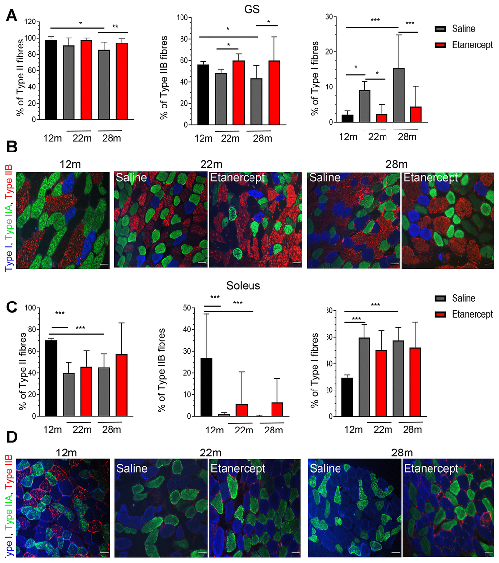 TNFα blockade inhibited the loss of type II fast twitch fibers. (A) Percentage of Type II (left), Type IIB (middle) and Type I (right) fibers in GS muscles of 12 months old mice in controls (saline) or Etanercept-treated mice at 22 and 28 months of age, *=pB) Representative images of GS muscle sections. Type I fibers are blue, type IIA are green, type IIB are red. Scale bar=50 μm. (C) Percentage of Type II (left), Type IIB (middle) and Type I (right) fibers in soleus muscles of 12 months old mice or in control or Etanercept-treated mice at 22 and 28 months of age. *=pD) Representative images of soleus muscle sections. Scale bar=50 μm.