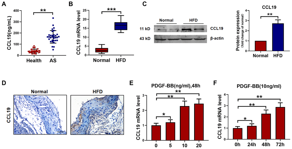 CCL19 expression in AS. (A) Detection of CCL19 expression in peripheral blood of patients by ELISA. n=32. (B) qRT-PCR analysis of CCL19 mRNA levels normalized to GAPDH in AS mice aorta and normal aorta tissues. n=10. (C) CCL19 protein levels in the AS or normal mice aorta tissues was performed by western blot. n=4. (D) Representative images of IHC of CCL19 in AS model mice aorta tissues and normal aorta tissues. Bar=50 μm. The effect of different concentrations (E) or different duration (F) of PDGF-BB on the expression of CCL19 was detected by qRT-PCR. n=5. *P