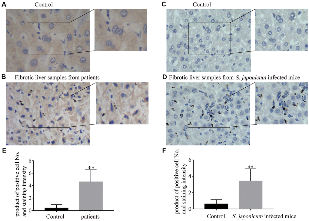 The expression of Bnip3 was increased in fibrotic liver tissues from clinical patients and Schistosoma japonicum infected mice. Expression of Bnip3 was identified in liver biopsy specimens from clinical patients, and mice infected with S. japonicum by immunohistochemistry. (A, B) Human samples from liver fibrosis were collected for Bnip3 detection by immunohistochemistry and liver samples of para-hemangioma from patients, were used as negative control. (A) Liver samples of para-hemangioma from patients (n=8). (B) Fibrotic liver samples from patients (n=8). Scale bar, 20 μm. (C, D) BALB/c female mice, 6–8 weeks old, were percutaneously infected with 25 cercariae of Schistosoma japonicum through the shaved abdomen, sacrificed at 8 weeks post-infection, and samples of liver were collected. (C) Non-infected liver samples from mice (n=4) and (D) fibrotic liver samples from S. japonicum infected mice (n=4). Scale bar, 20 μm. Representative images were shown. Positive cells were counted and the scores were multiplied with staining intensity. Products were introduced into SPSS 19.0 to analyze statistical difference of Bnip3 expression in normal liver tissues and fibrotic liver tissues. (E) Bnip3 in liver tissues from patients; (F) Bnip3 in liver tissues from S. japonicum infected mice. **P 