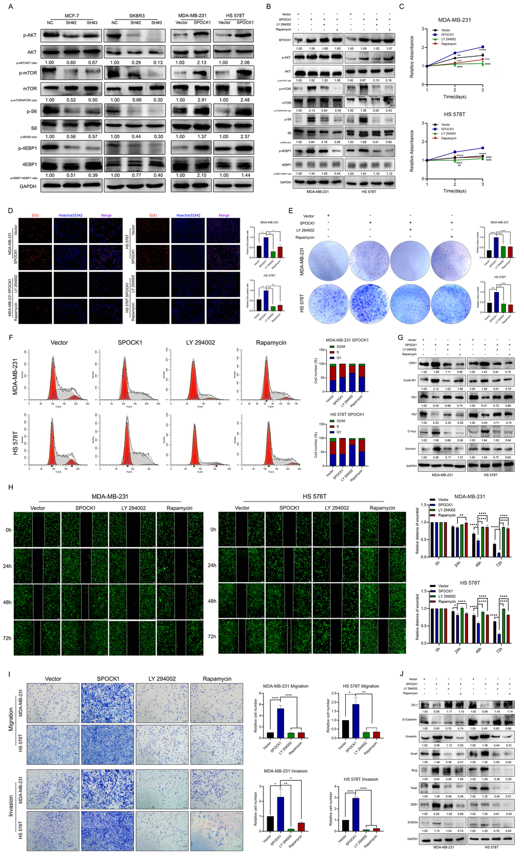 SPOCK1 activates the AKT/mTOR signaling pathway in BC cells. (A) Proteins level on AKT/mTOR pathway of indicated cells were assayed by western blotting. GAPDH was used as a loading control. (B) Stable BC cells were treated with LY 290042 or Rapamycin. Then indicated protein levels were assayed by western blotting. GAPDH was used as a loading control. (C–E) Cell viability was detected in SPOCK1-overexpressed cells after treatment with LY 290042 or Rapamycin by MTT assay (C), Edu staining (D) and colony formation (E) assays. (F) Cell cycle progression was assayed by flow-cytometry analysis after dealing with LY 290042 or Rapamycin. (G) Stable BC cells were treated with LY 290042 or Rapamycin. Then cell cycle related protein levels were assayed by western blotting. GAPDH was used as a loading control. (H–I) Cell motility and invasion capacities was detected in SPOCK1-overexpressed cells after treatment with rapamycin or LY294002. (J) Stable BC cells were treated with LY 290042 or Rapamycin. Then levels of EMT-related proteins were assayed by western blotting. GAPDH was used as a loading control. (*PPPP