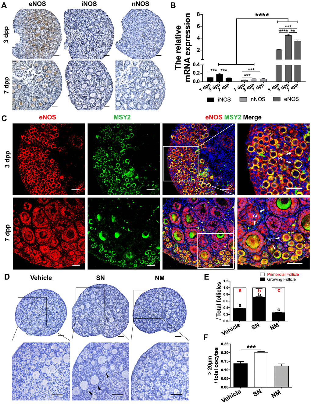 eNOS was involved in PF activation. (A) Immunohistochemical staining of eNOS, iNOS and nNOS in ovaries at 3 dpp and 7 dpp. Scale bar, 40 μm. (B) The relative mRNA levels of eNOS, iNOS and nNOS were assessed in ovaries from 1-7 dpp using qRT-PCR. (C) Immunofluorescence staining of eNOS in ovaries at 3 dpp and 7 dpp. Sections were labeled for eNOS (red), the oocyte marker Y box protein 2 (MSY2, green) and the nuclear marker Hoechst (blue). Arrows indicate PFs and triangles indicate GFs. Scale bar, 40 μm. (D) Ovaries at 1 dpp were treated with the vehicle, the NO donor SN (100 μM) or the NO inhibitor NM (1 mM) for six days (n=6). The ovarian morphology was analyzed after hematoxylin staining. Triangles indicate GFs. Scale bar, 40 μm. (E) The numbers of PFs and GFs/the total number of follicles were analyzed. (F) The numbers of oocytes with diameters larger than 20 μm were counted. **, *** and **** denote statistical significance at p p p p 