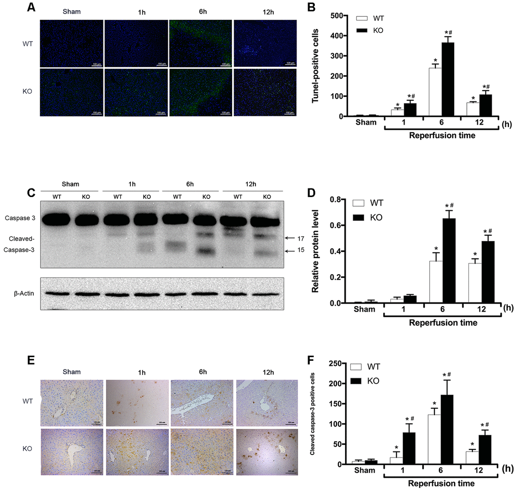 ARRB2 inhibits hepatocyte apoptosis in hepatic ischemia-reperfusion injury. (A) and (B), TUNEL staining of the liver tissue and quantitative analysis of TUNEL positive cells (green) in Sham, WT + IR and KO + IR groups. (C) and (D), Cleaved Caspase-3 protein level in liver tissue detected by Western Blotting. β-actin was used as an internal control. (E) and (F), The Immunohistochemical staining of Cleaved Caspase-3 in liver tissues. The data are presented as the Mean ± SD, n = 6. *P#P 