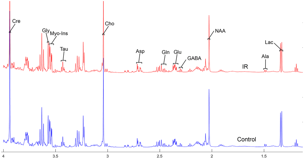 The normalized 1H NMR spectra of extracts in medulla-pons after MIRI. Note: Lac, lactate; GABA, gamma-aminobutyric acid; NAA, N-acetylaspartate; Asp, aspartate; Glu, glutamine; Gln, Glutamate; Cre, creatinine; Cho, choline; Myo, Myo-inositol; Tau, taurine; Ala, alanine; Gly, glycine.
