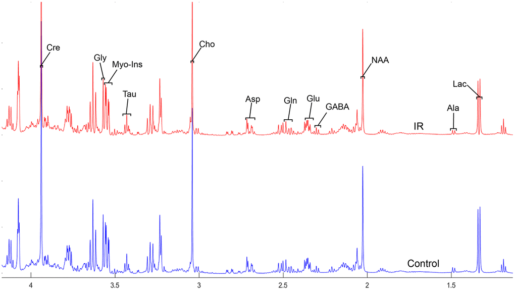 The normalized 1H NMR spectra of extracts in the parietal cortex after MIRI.
