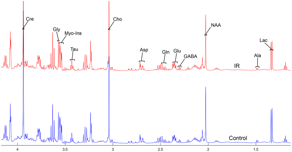 The normalized 1H NMR spectra of extracts in the thalamus after MIRI.