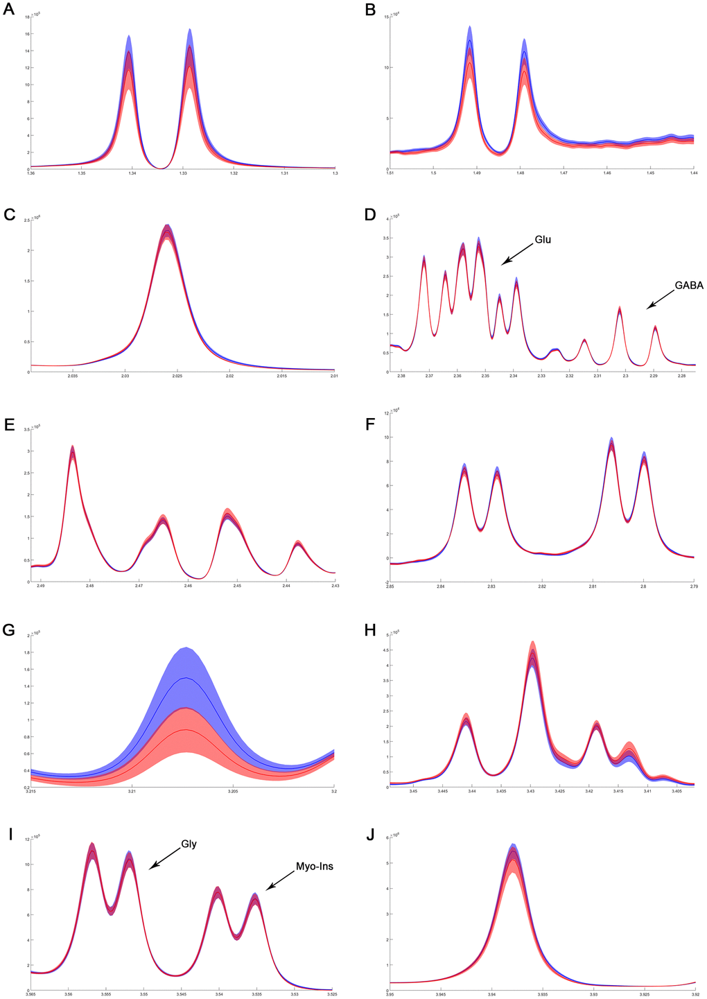 The difference in metabolites of normalized spectra in medulla-pons after MIRI. (A) Lactate; (B) Alanine; (C) N-acetylaspartate; (D) GABA and Glutamate; (E) Glutamine; (F) Aspartate; (G) Choline; (H) Taurine; (I) Myo-inositol and Glycine; (J) Creatinine. The spectral line and the width of its shadow represent mean and standard deviation, respectively. Control group: blue line with shadow around; IR group: red line with shadow around.