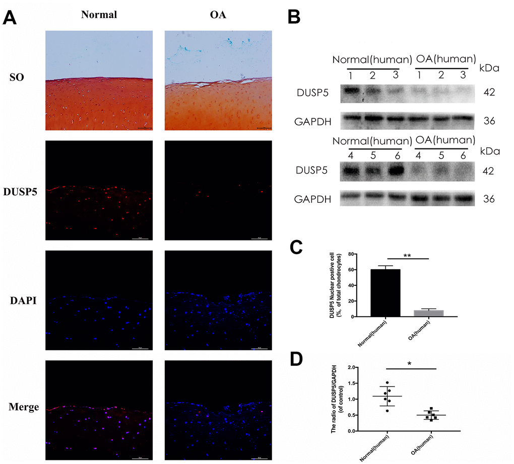 DUSP5 levels in normal and OA human knee articular cartilage. (A) Representative images of safranin O staining and immunofluorescence staining of DUSP5 in human knee articular cartilage from normal individuals and patients with OA. (B, D) The protein expression and quantitation of DUSP5 in human chondrocytes derived from normal individuals and patients with OA. GAPDH was used as a control. (C) Quantitation of immunofluorescence staining of DUSP5 in human knee articular cartilage from normal individuals and patients with OA. All data are expressed as mean±S.D. (n = 3). *p